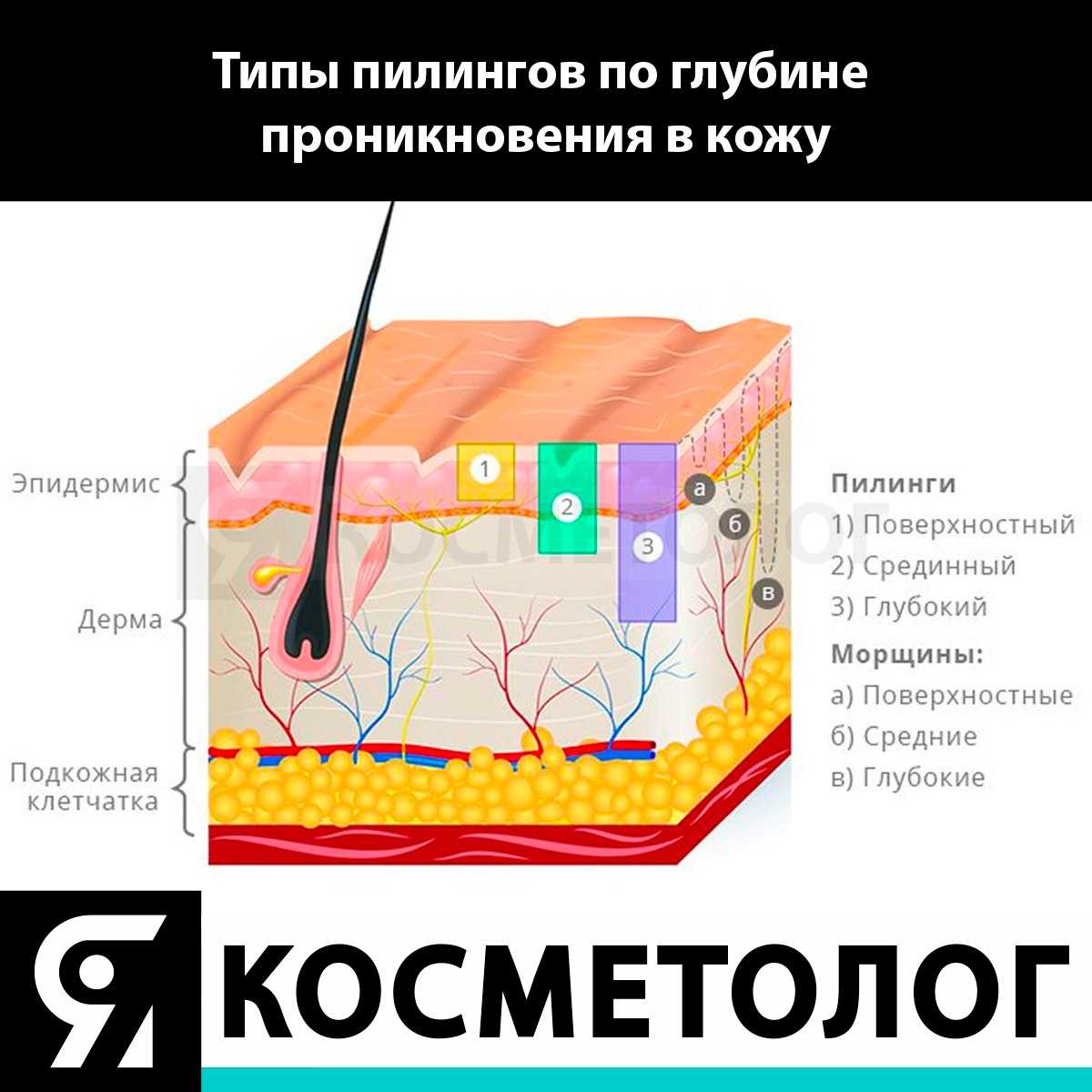 Химический пилинг – виды, плюсы и минусы процедуры