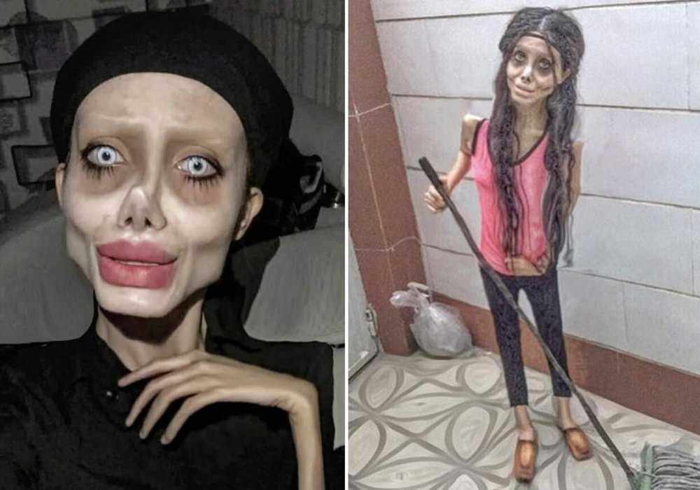 Angelina jolie plastic surgery before and after photos