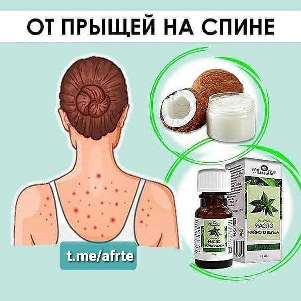 15 необычных домашних средств от прыщей