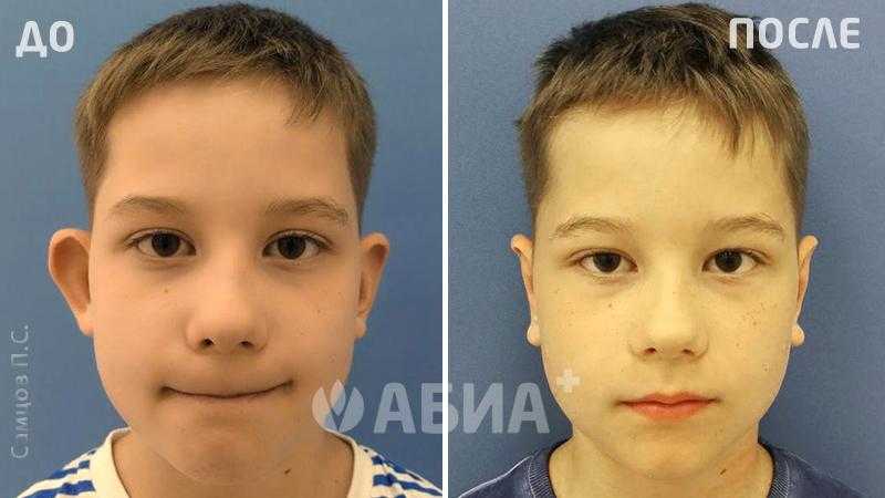 5 доказательств того, что мужчины любят ушами