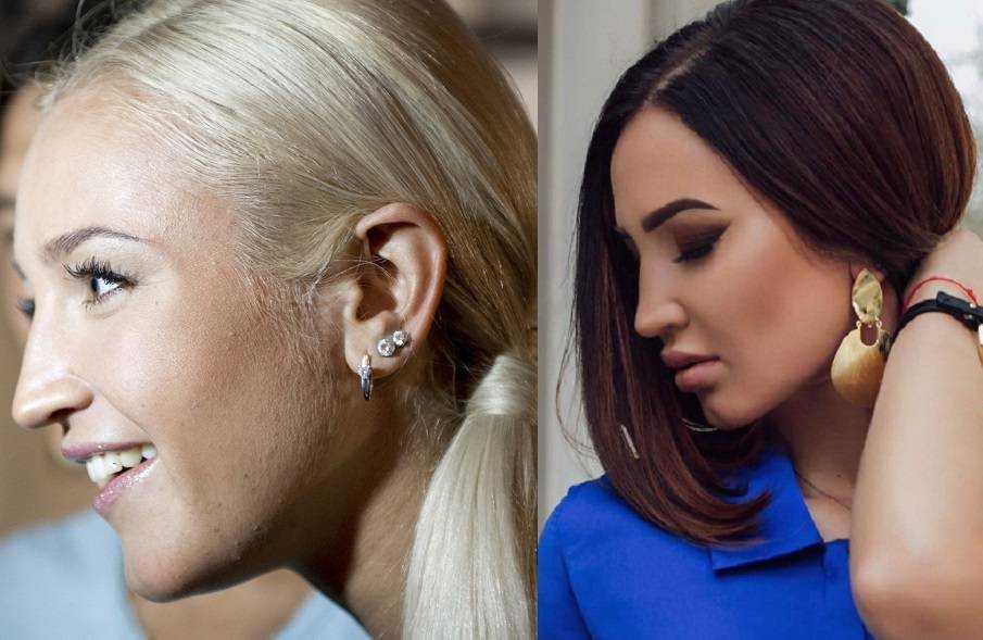 Ольга бузова: пластика носа, губ, какую еще делала, изменения до и после нее