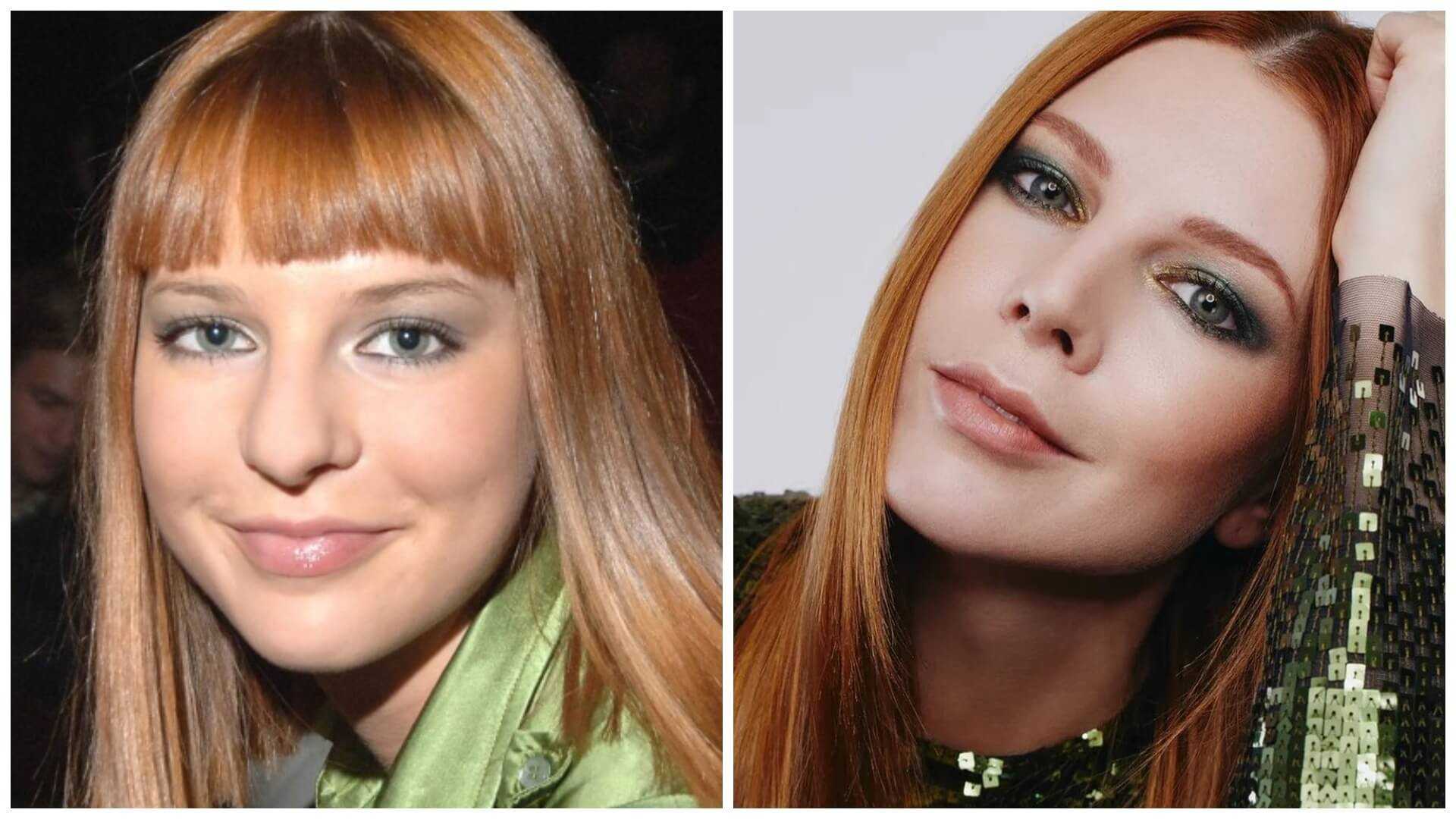Наталья подольская до и после пластики