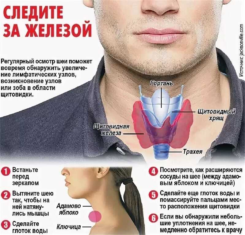 Разрастание тканей эндокринного органа или зоб щитовидной железы: симптомы и лечение народными средствами в домашних условиях