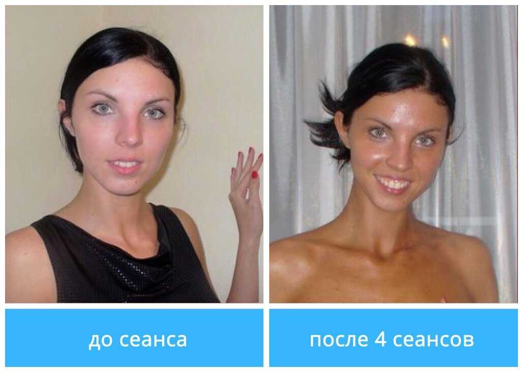 Что такое коллариум: преимущества и недостатки