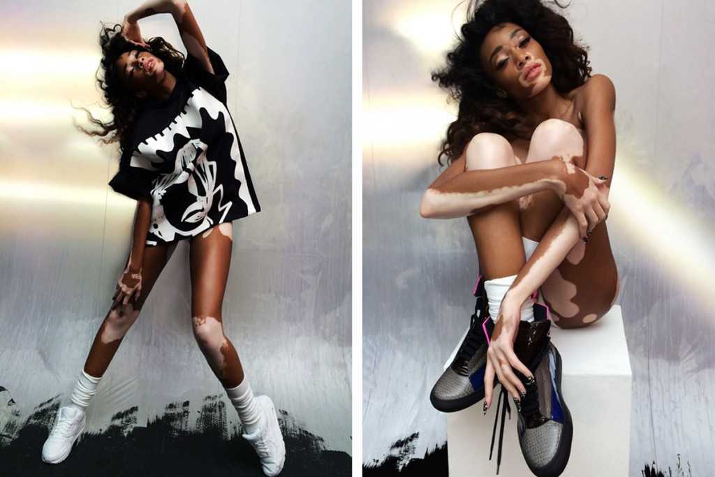Winnie harlow (model) wiki, bio, age, height, weight, boyfriend, measurements, net worth, family, facts