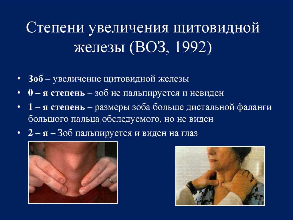 Лечение диффузно узлового зоба народными средствами | портал о народной медицине
