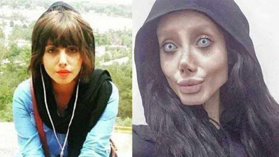 Жизненный путь анджелины джоли до и после пластики