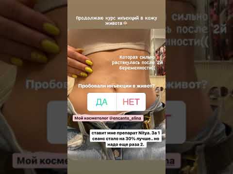 Хилькевич с новой попой расстроилась, что ей не дали премию “новые формы”