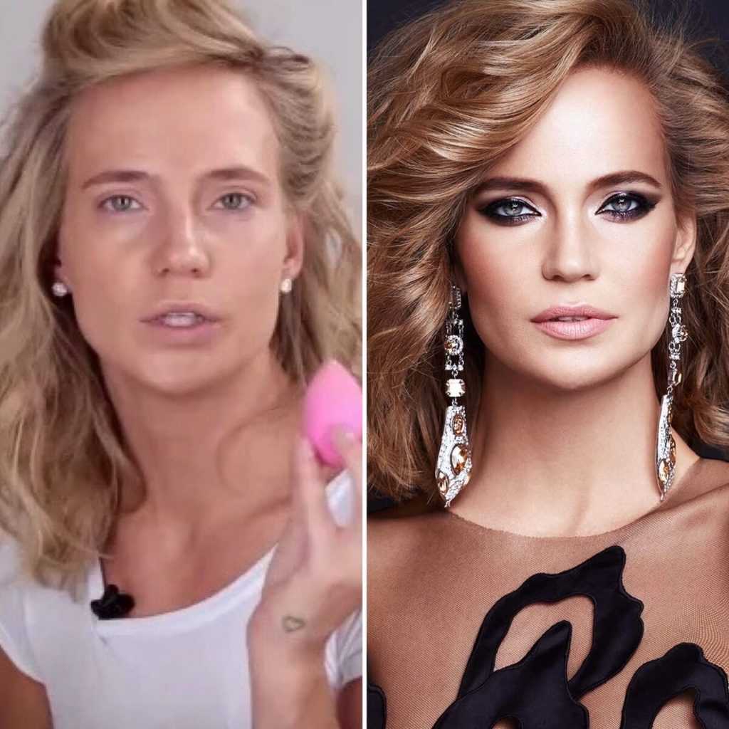 Делала ли пластику глюкоза?