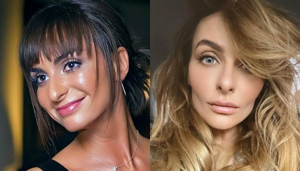 Почему не стоит приходить к пластическому хирургу с фото знаменитости
