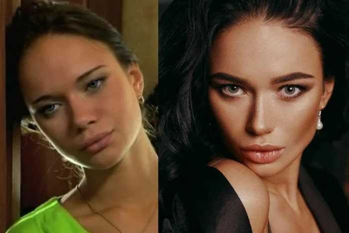 Яна кошкина до и после пластики: как внешность помогла сделать карьеру