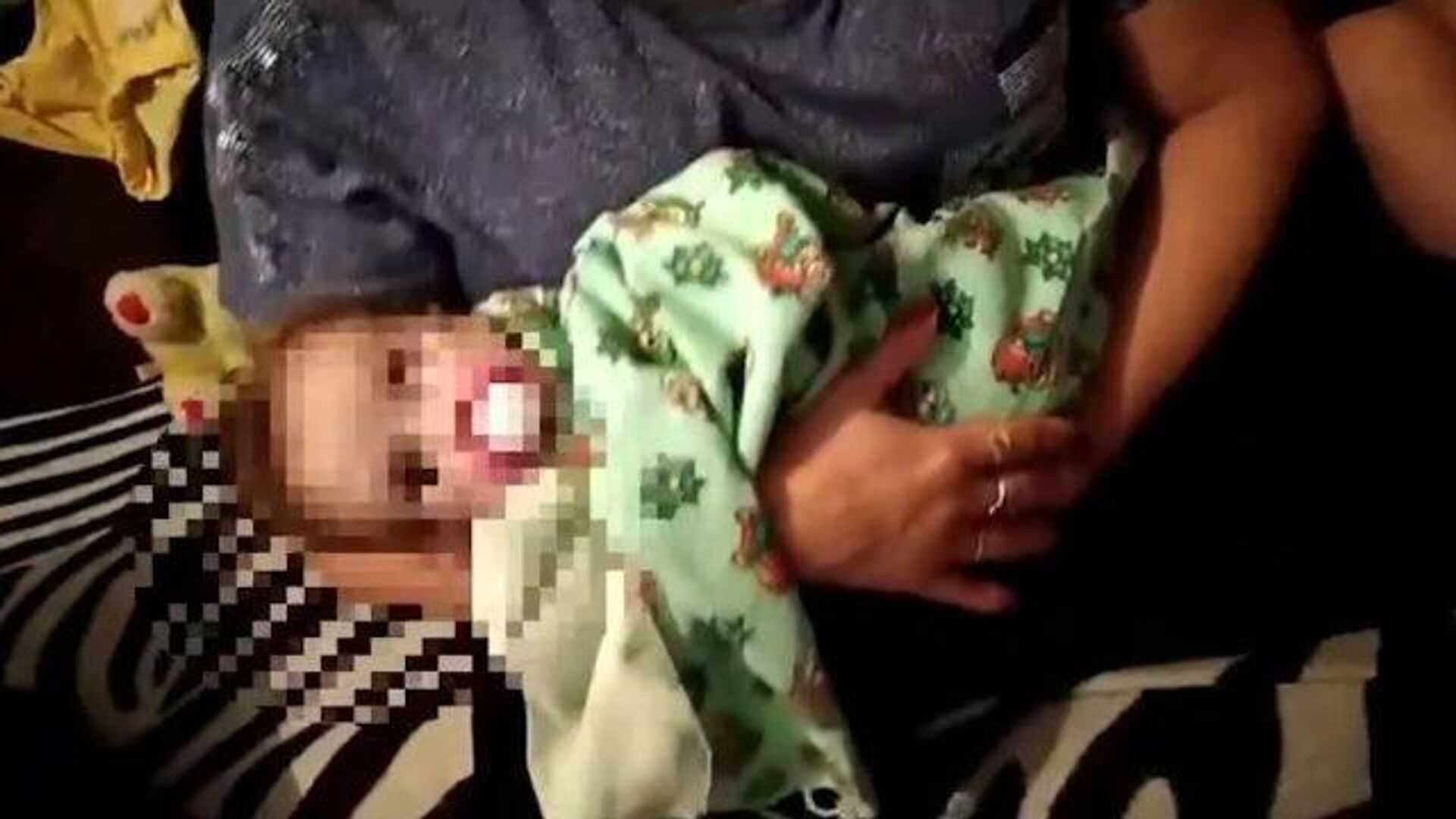 История матвея: как живет получивший страшные ожоги в роддоме ребенок