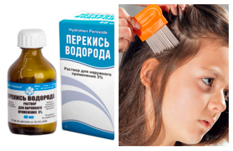 Как изменить цвет волос перекисью водорода?