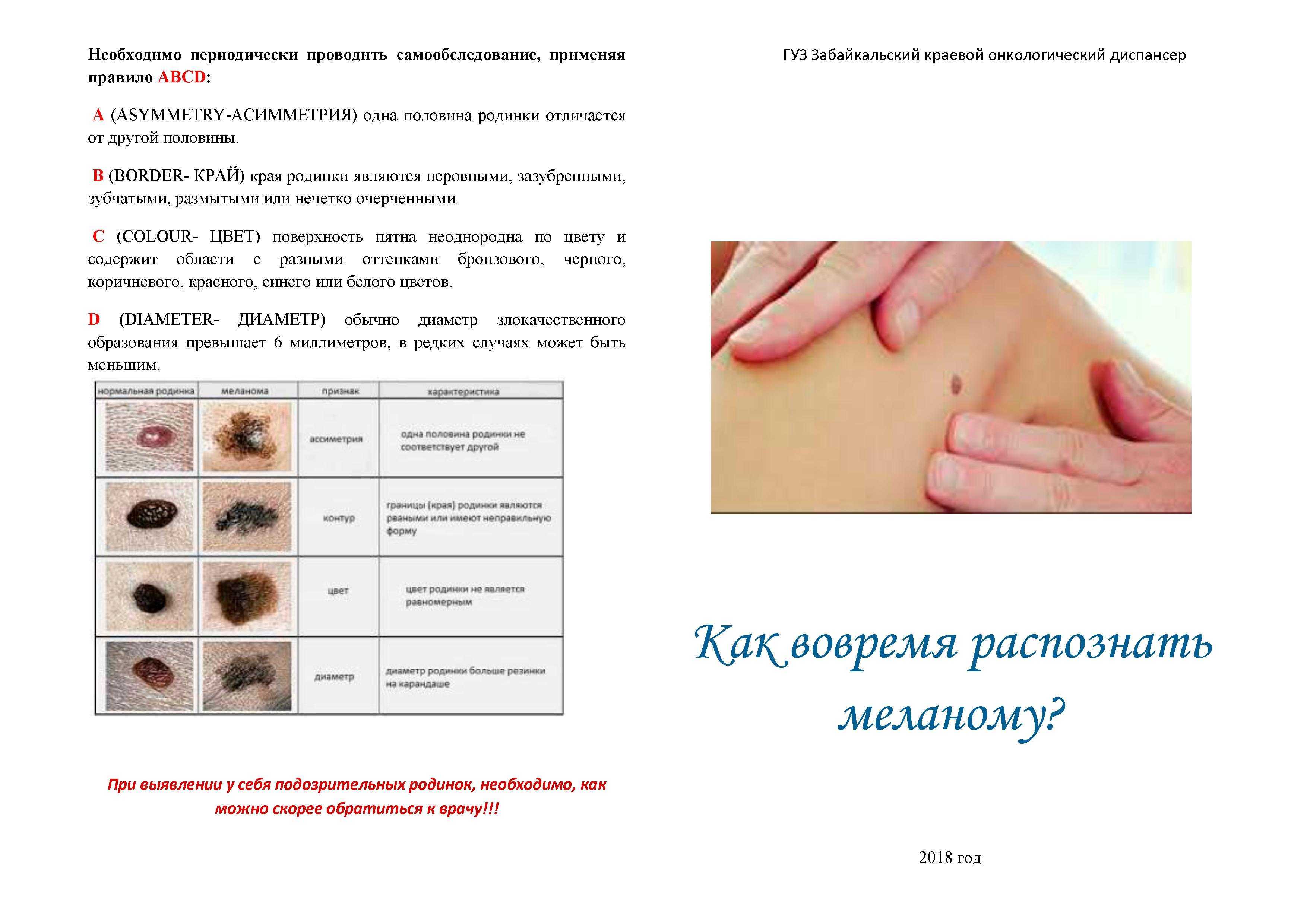 Российские актрисы с родинкой на лице