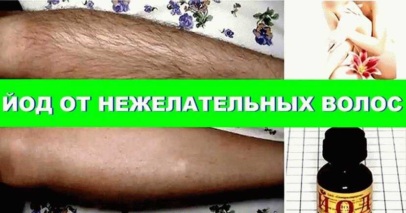 Как навсегда удалить волосы: эффективные средства для избавления от нежелательных волосков на теле
