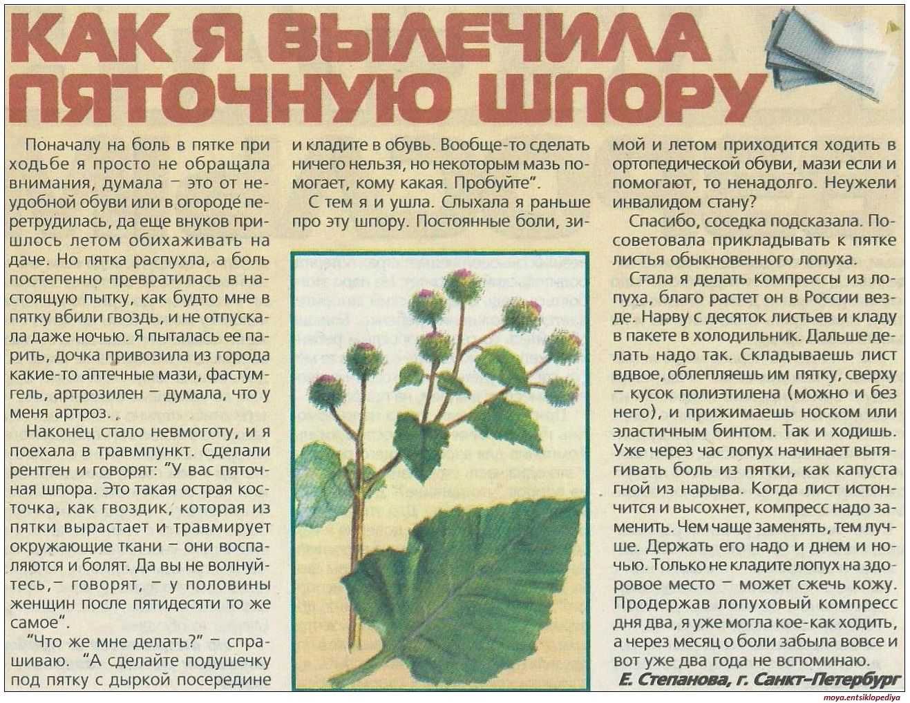 Герпес на губе лечение быстро в домашних условиях, фото | вирус герпес