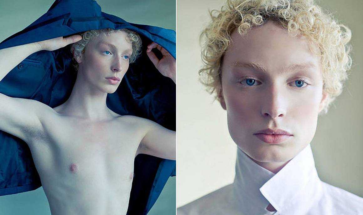 London: unique agency for models with disabilities redefines beauty