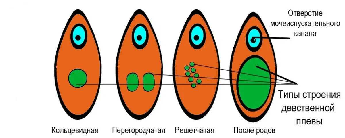 Девственность, телегония, их значение в жизни мужчин и женщин