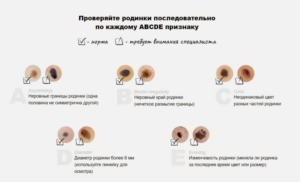 Ольга дроздова до и после пластики, фото, как выглядит сейчас 2023 (2 видео)