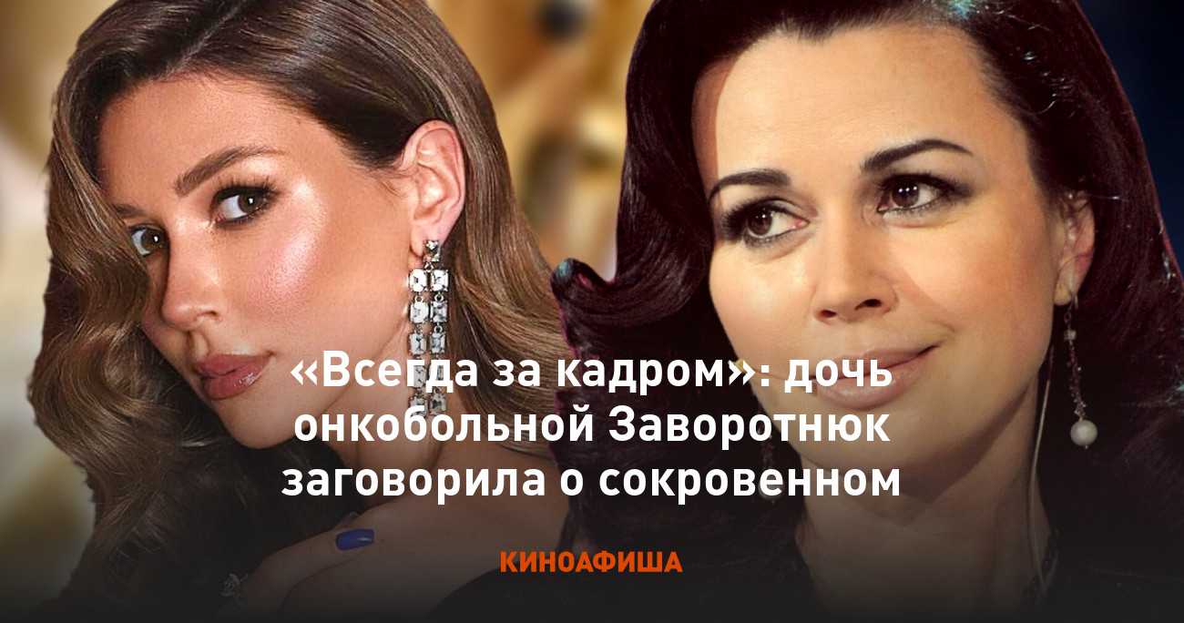 Звёзды кино, которым помогла добиться успеха их неординарная внешность